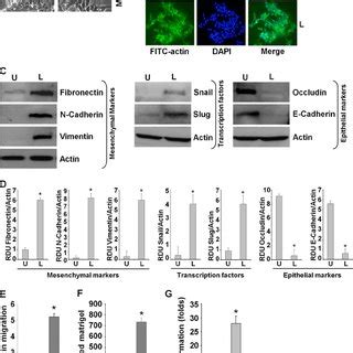 Leptin Induces Epithelial Mesenchymal Transition Tumorsphere