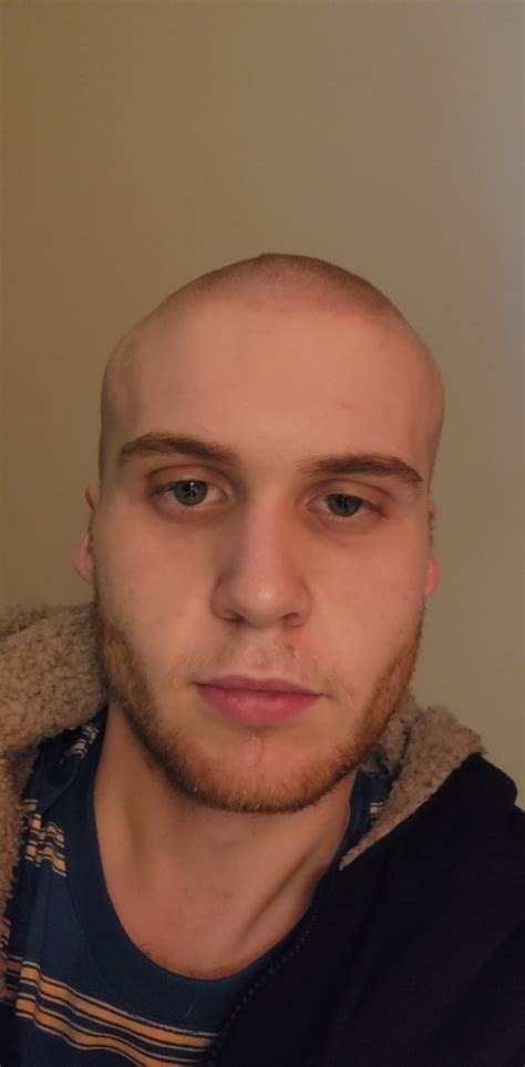 Am I Balding Im 24m I Can Almost See Through My Hair With Light R