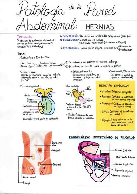 Hernias Anatom A Apuntes De Medicina Udocz