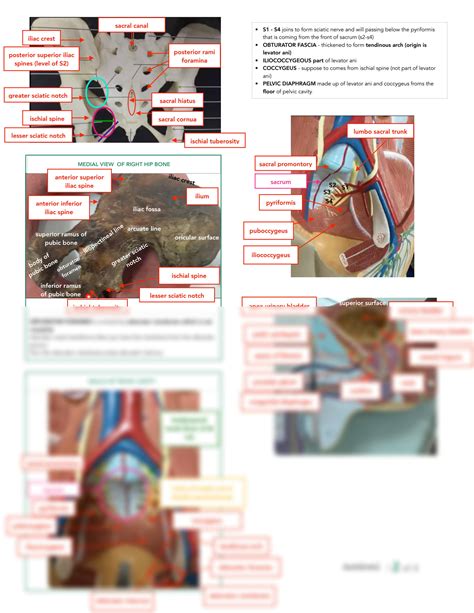 Solution Pelvis Pelvic Cavity And Contents Studypool