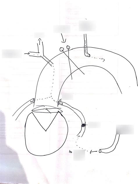 Aortic Root Diagram Diagram | Quizlet