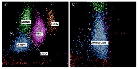 Diagnostics Special Issue Advances In Hematology Laboratory