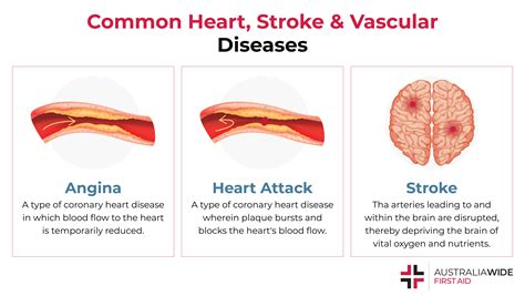 First Aid For Heart Stroke