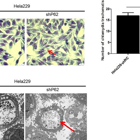 Chlamydia Trachomatis Induces P62 Dependent Autophagy In HeLa229 Cells