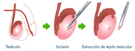 Bipsia Testicular Fertilab