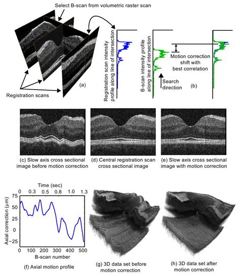 Ultrahigh Speed Spectral Fourier Domain OCT Ophthalmic Imaging At