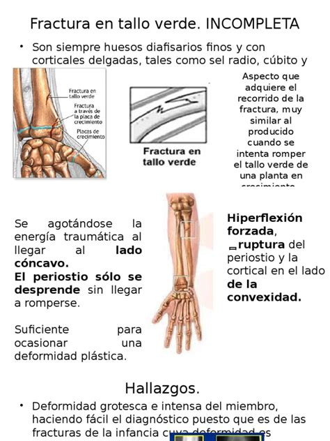 Fractura Tallo Verde Y Femur