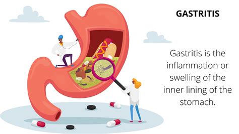 6 reasons of gastritis