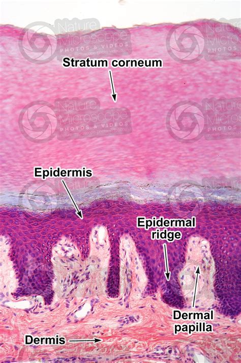 Epidermal Ridge