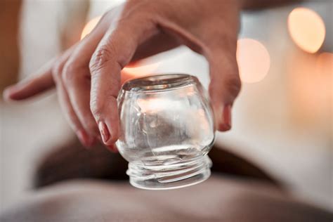 How Does Cupping Help With Recovery SOHMA Integrative Medicine