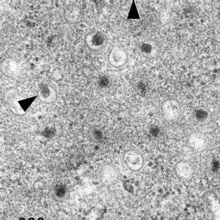 Capsids In The Host Cell Nucleus Nuclear Capsids Of Khv Can Be Largely