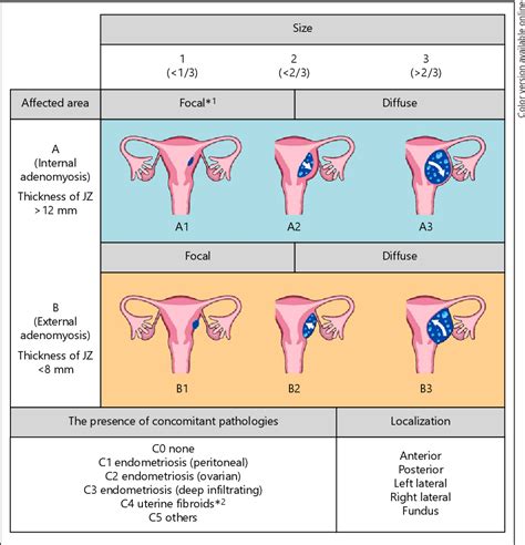 A Classification Proposal For Adenomyosis Based On Magnetic Resonance