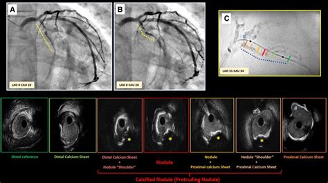 Frontiers The Role Of Invasive And Non Invasive Imaging Technologies