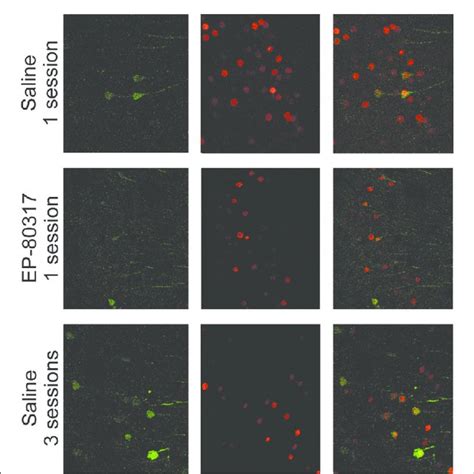 Double Immunofluorescence Confocal Laser Scanning Micrographs Of Mice