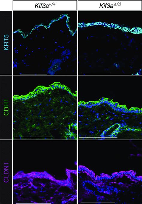 Kif A K Mice Have Disrupted Adherens Junction And Tight Junction