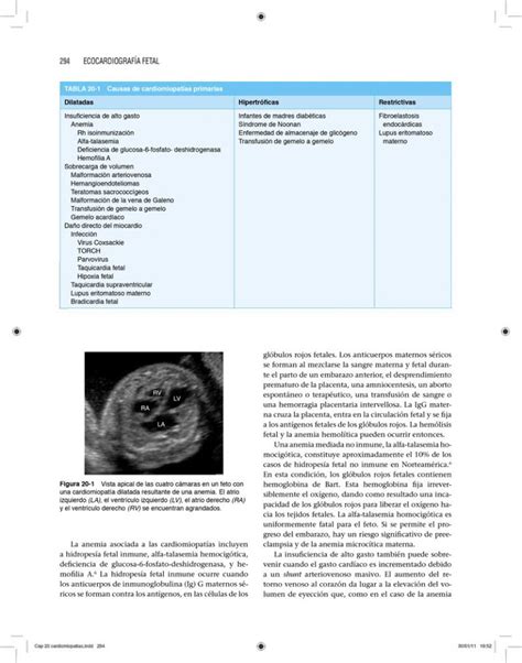 Libro Ecocardiograf A Fetal Era Edici N En Campus