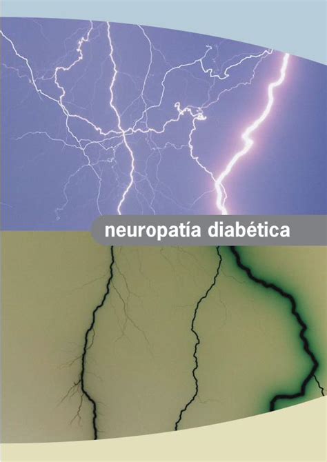 PDF Neuropatía Diabética clinidiabet de variabilidad del