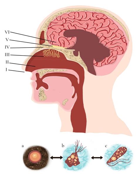 Primary Amoebic Meningoencephalitis By Naegleria Fowleri Pathogenesis And Treatments