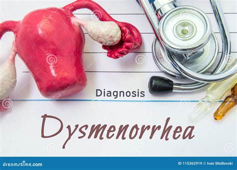 Diagnosis Del Dysmenorrhea Historial M Dico Del Paciente Con La