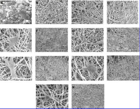 T Fibroblast Cell Morphology On Different Fiber Diameter