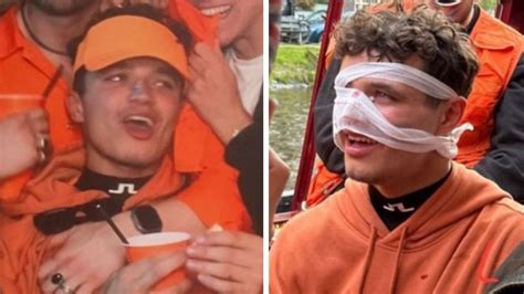 F1 Star Lando Norris Gets Injured Partying In Amsterdam The Advertiser