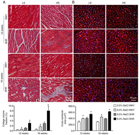 Chronic Highsalt Intake Induces Cardiomyocyte Autophagic Vacuolization