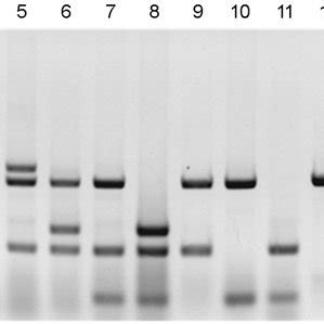 Amplicon Patterns Of Virulence Associated Genes By Multiplex PCR A