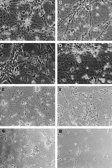 Primary Cultures Of Rat Cortical Neurons At The 7 Th Dic Continuously