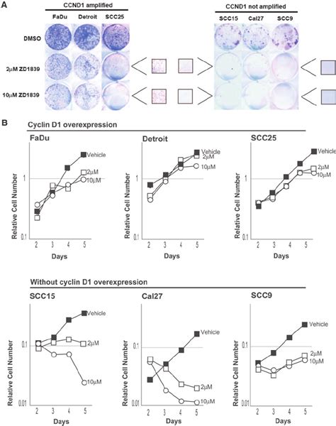 Sensitivity Of Hnscc Cell Lines To Gefitinib Zd Treatment A