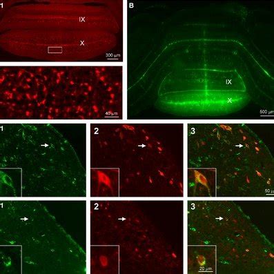 Retrogradely Labeled Tomato Neurons In The MVN And PHN A Low 1