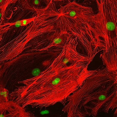 Human Retinal Pericytes Innoprot Ocular Cell System