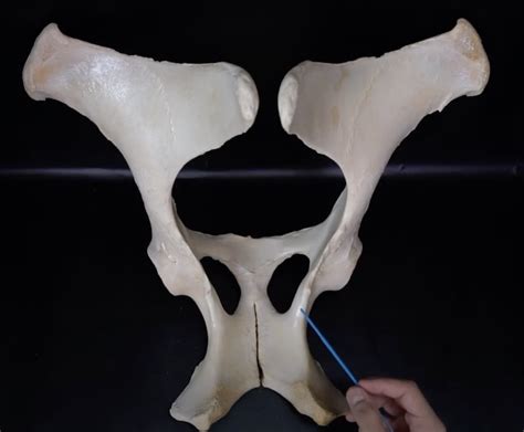 Pelvic Bones Os Coxae Latin Diagram Quizlet