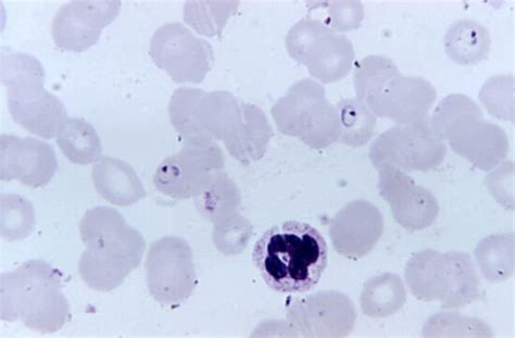 Kostenlose Bild Plasmodium Falciparum Gametocyte Bestehend