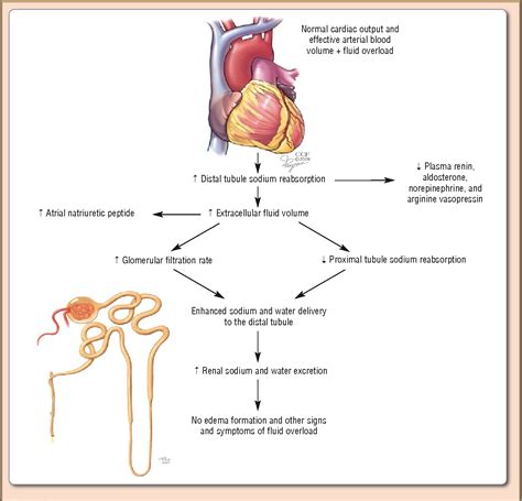 Figure From Fluid Management Strategies In Heart Failure Semantic