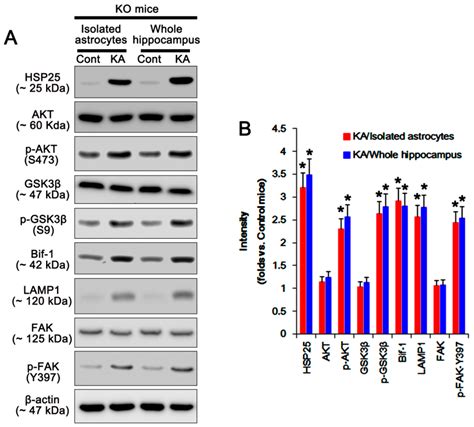 Ijms Free Full Text P2 × 7 Receptor Inhibits Astroglial Autophagy