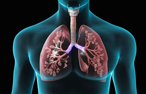 Boletim Infogripe Indica Aumento De S Ndrome Respirat Ria Aguda Grave