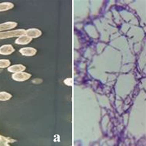 Macroscopic A And Microscopic B Images Showing The Characteristics Of