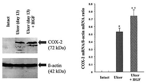 1 Representative Western Blot Analysis Of Cox 2 Protein And β Actin Download Scientific