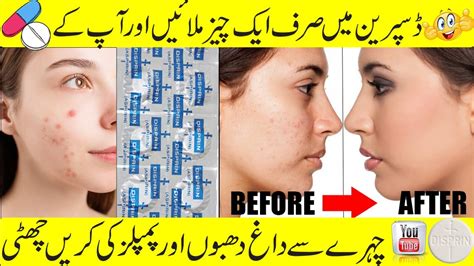 Disprin Tablet For Skin ACNE Scars Whitening WORKS Or Not How To