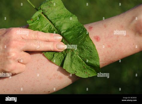 Traiter Une Piq Re D Ortie Feuille Avec Un Dock Photo Stock Alamy