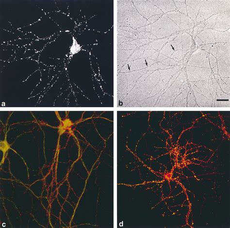 Expression Of Synaptopodin In Cultured Hippocampal Neurons A In