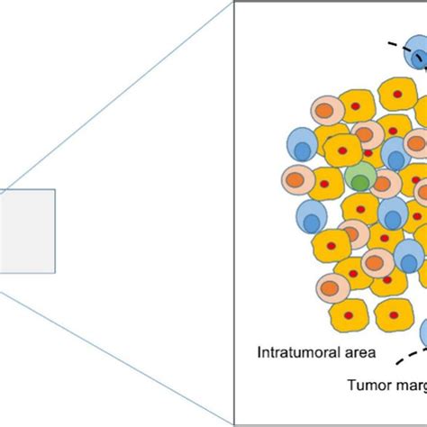 Overview Of Different Types Of Tumor Infiltrating Lymphocytes In Cca