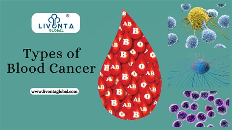 Types Of Blood Cancer Livonta Global Pvt Ltd
