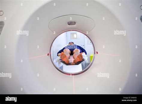 Abdominal ct scan abdomen Banque de photographies et dimages à haute