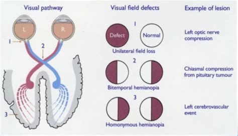 Clin Skills Cranial Nerves 1 Flashcards Quizlet