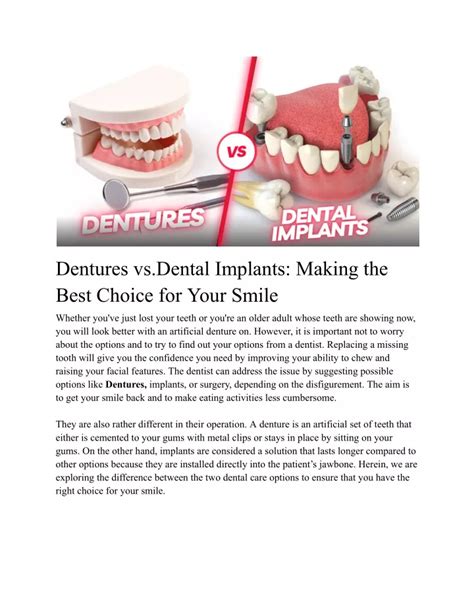 PPT Dentures Vs Dental Implants Making The Best Choice For Your