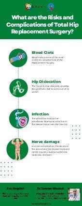 Total Hip Replacement Risks and Complications.pdf | Free Download