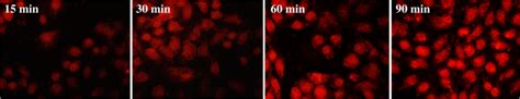 In Vitro Internalization Of Rhodamine B Loaded Quinacrine Loaded