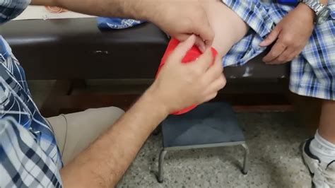 Vendaje de muñón de amputación bajo rodilla transtibial YouTube