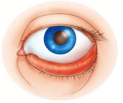 Chapter Special Senses The Eyes And Ears Flashcards Quizlet